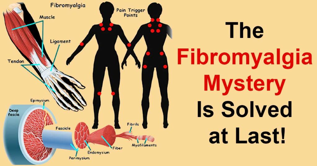 Try CBD for Fibromyalgia